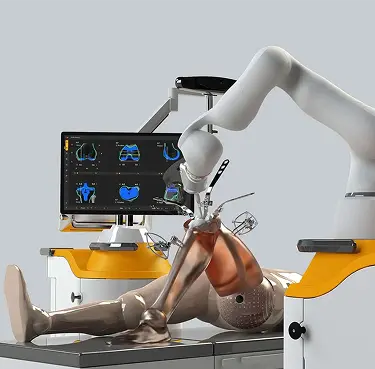 Robotic Knee Replacement Surgery