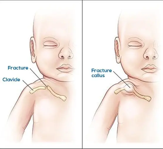 Overview of Pediatric Orthopedic Care