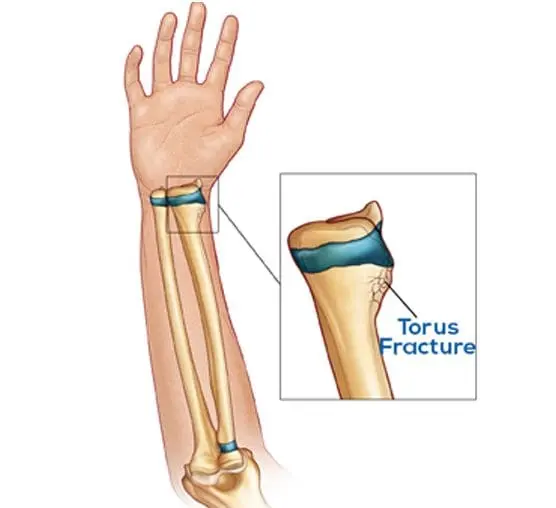 Child Bone Specialist benefits and treatment overview