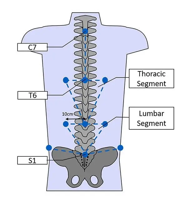 Chronic Back Pain Treatment benefits and treatment overview