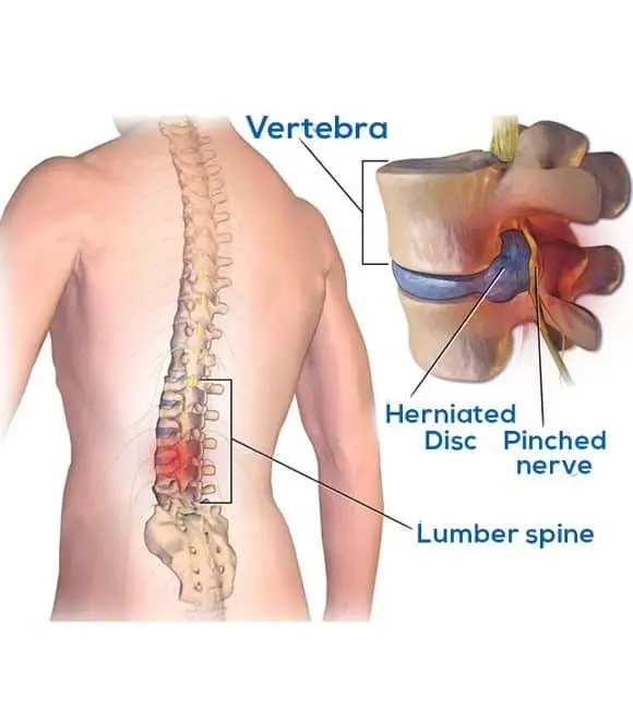 Causes and Risk Factors