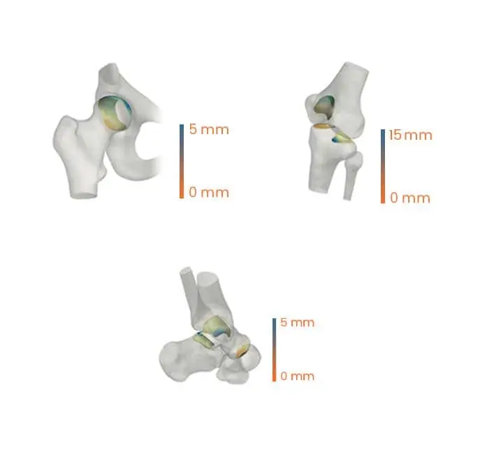Scope of Orthopaedic Trauma Services at Hunjan Hospital Ludhiana
