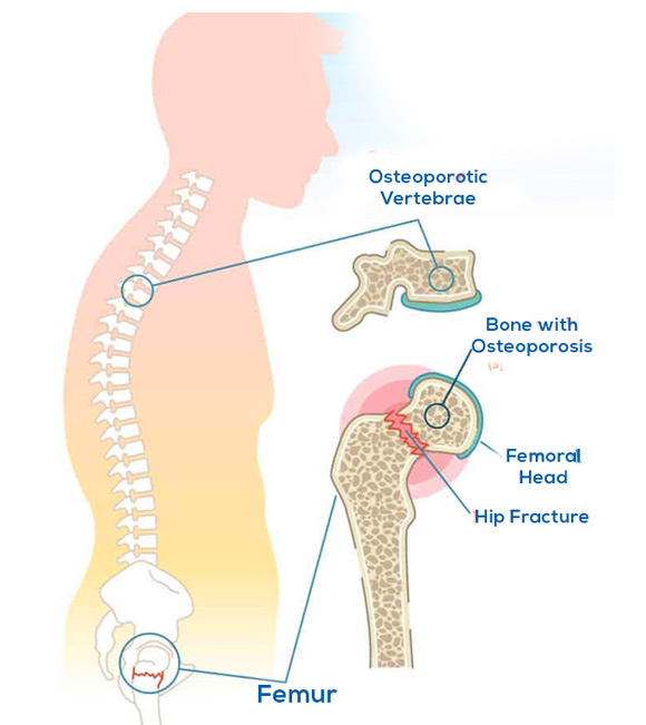 Chronic Back Pain Treatment