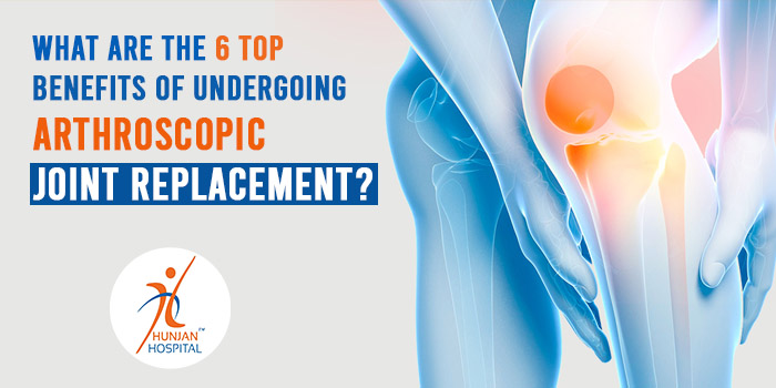 What are the 6 top benefits of undergoing arthroscopic joint replacement