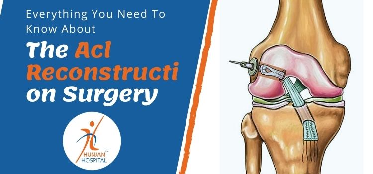 Everything you need to know about the ACL reconstruction surgery