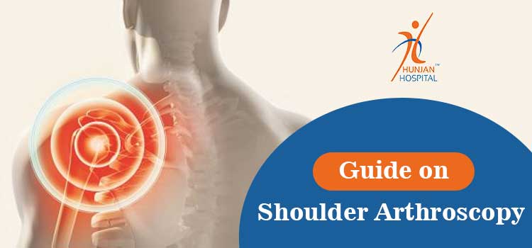 What all do you have to know about shoulder arthroscopy surgery?