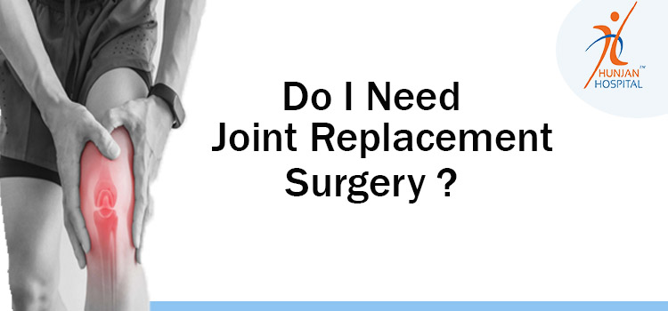 Do I Need Joint Replacement Surgery