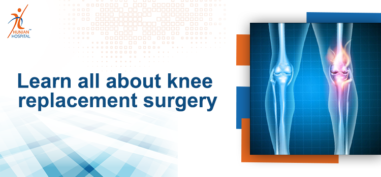 Learn all about knee replacement surgery